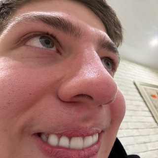 ЧЧЕРНО