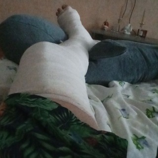Сломал ногу