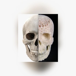 N|P Anatomy