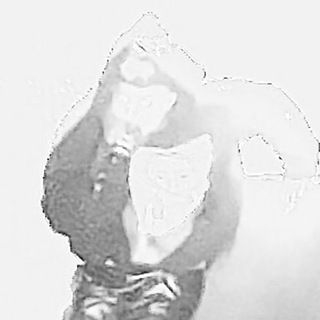 YPCB